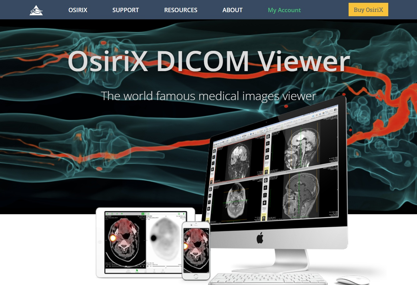 инструкция по оплате Osirix MD из России